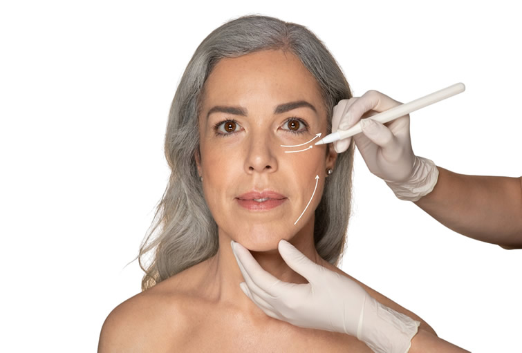 Lifting Facial